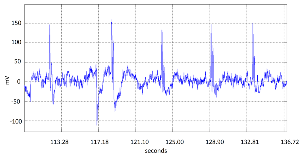 Sensors 13 10561f4 1024
