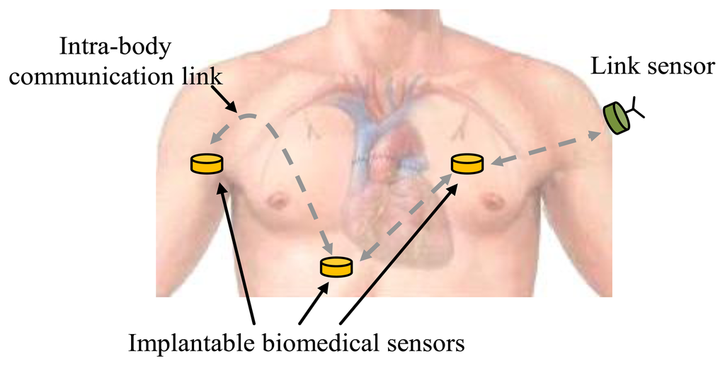 Sensors 14 01740f1 1024