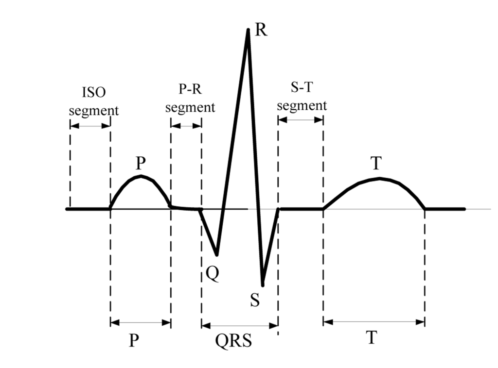 Sensors 14 05994f2 1024