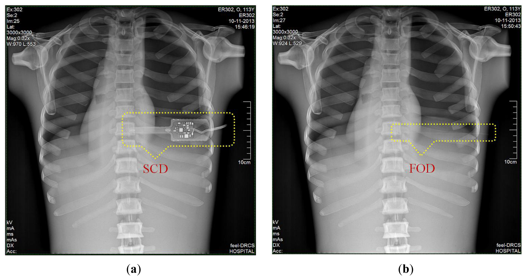 Sensors 14 06305f9 1024