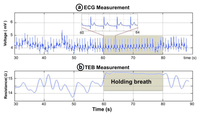 Sensors 14 07120f11 200
