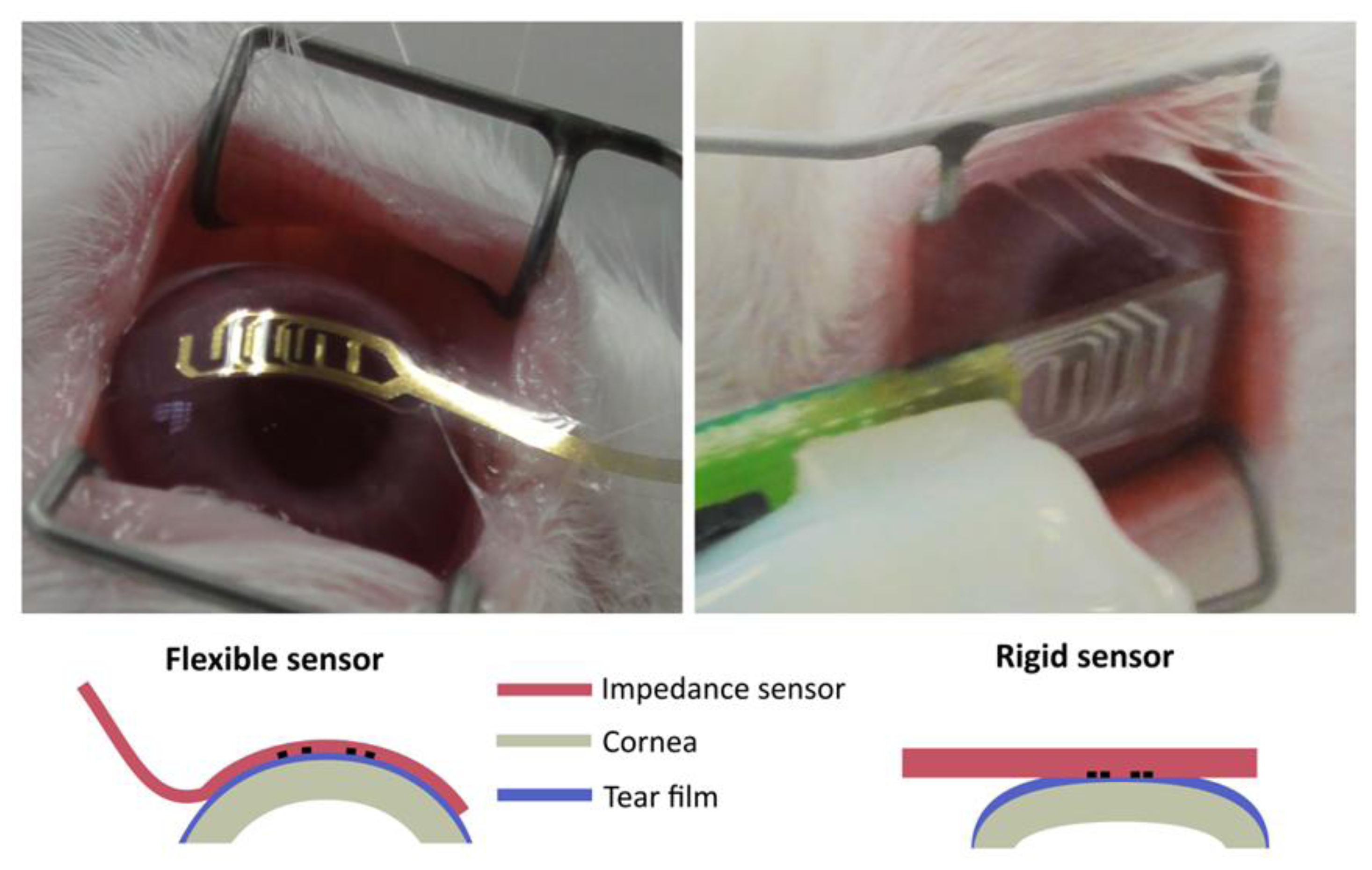 Sensors 14 08718f1 1024