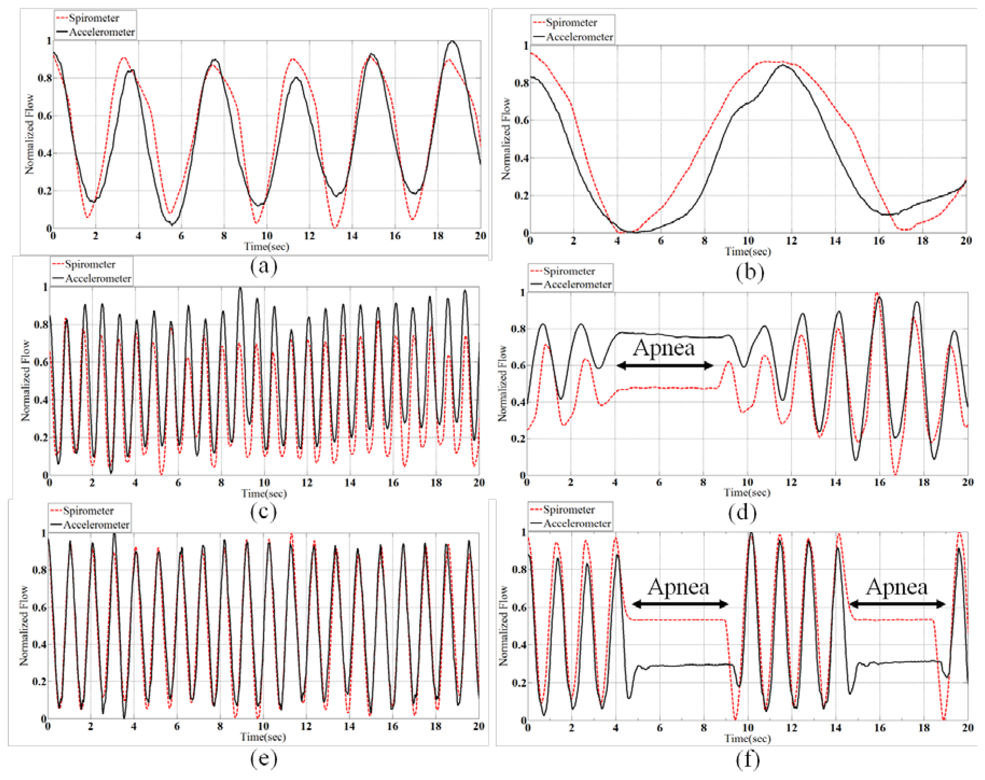 sensors free full text a medical cloud based platform for types of breathing patterns