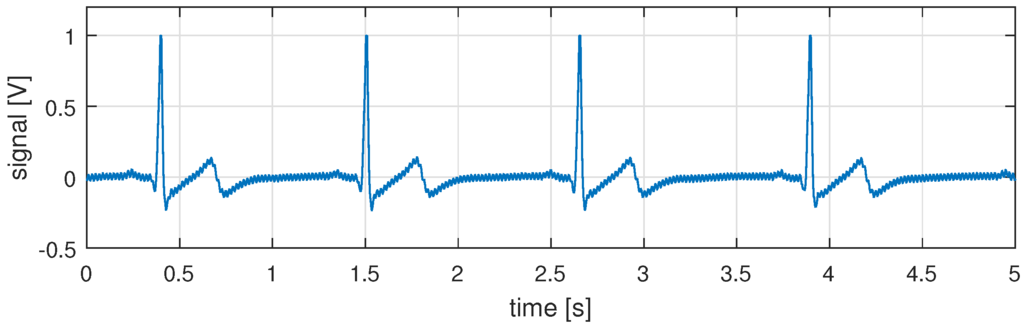 Sensors 16 00570 g005 1024