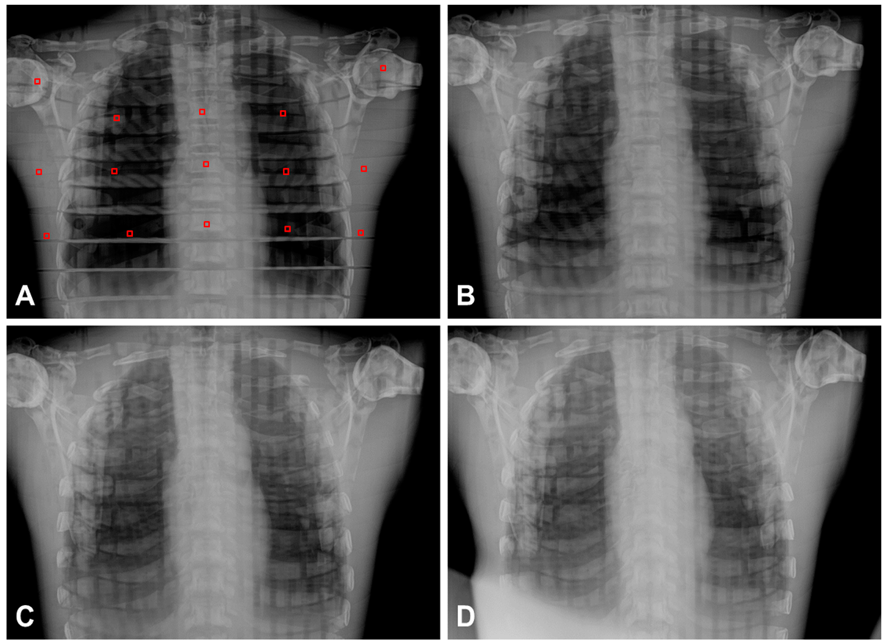 digital radiography