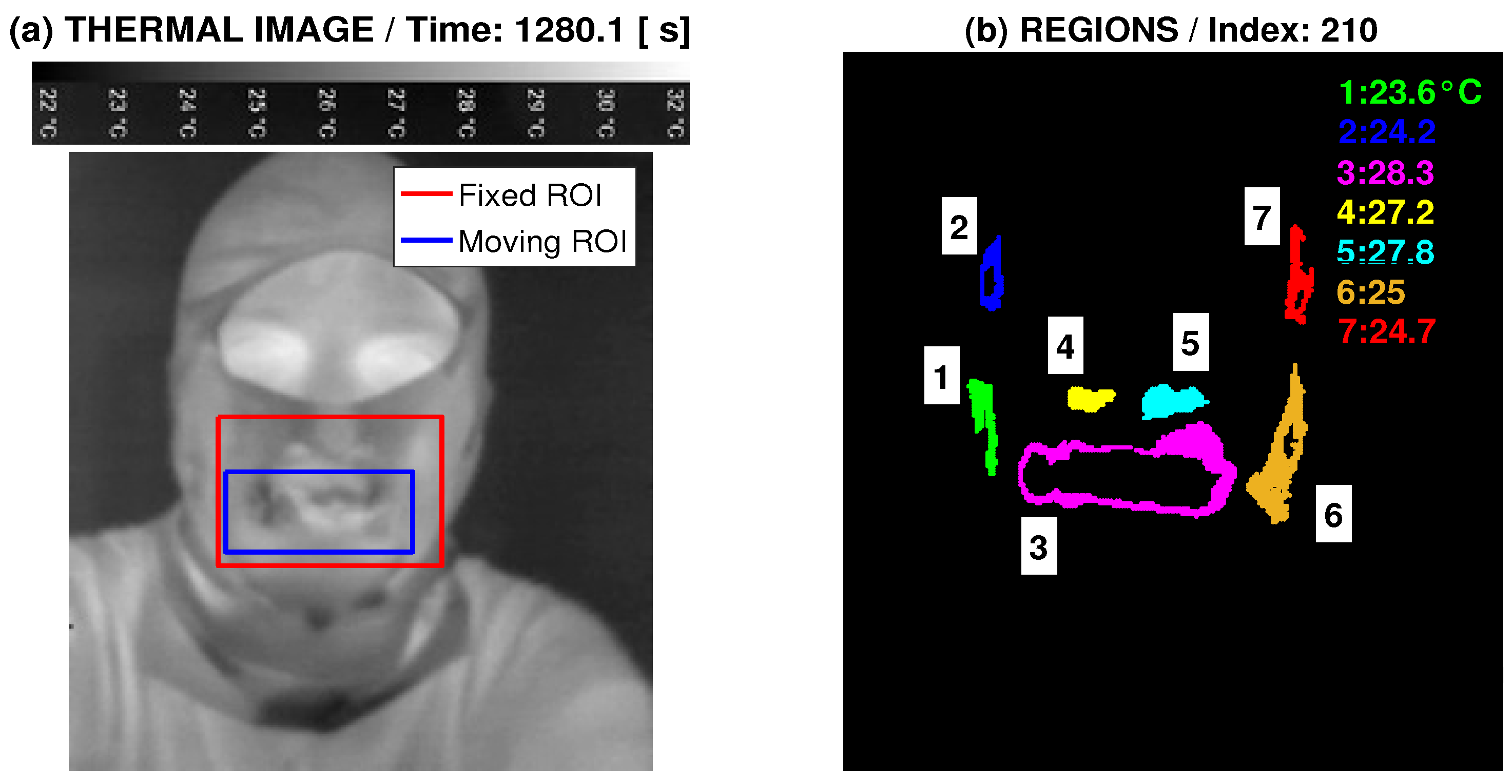 Sensors Free FullText Breathing Analysis Using Thermal and Depth