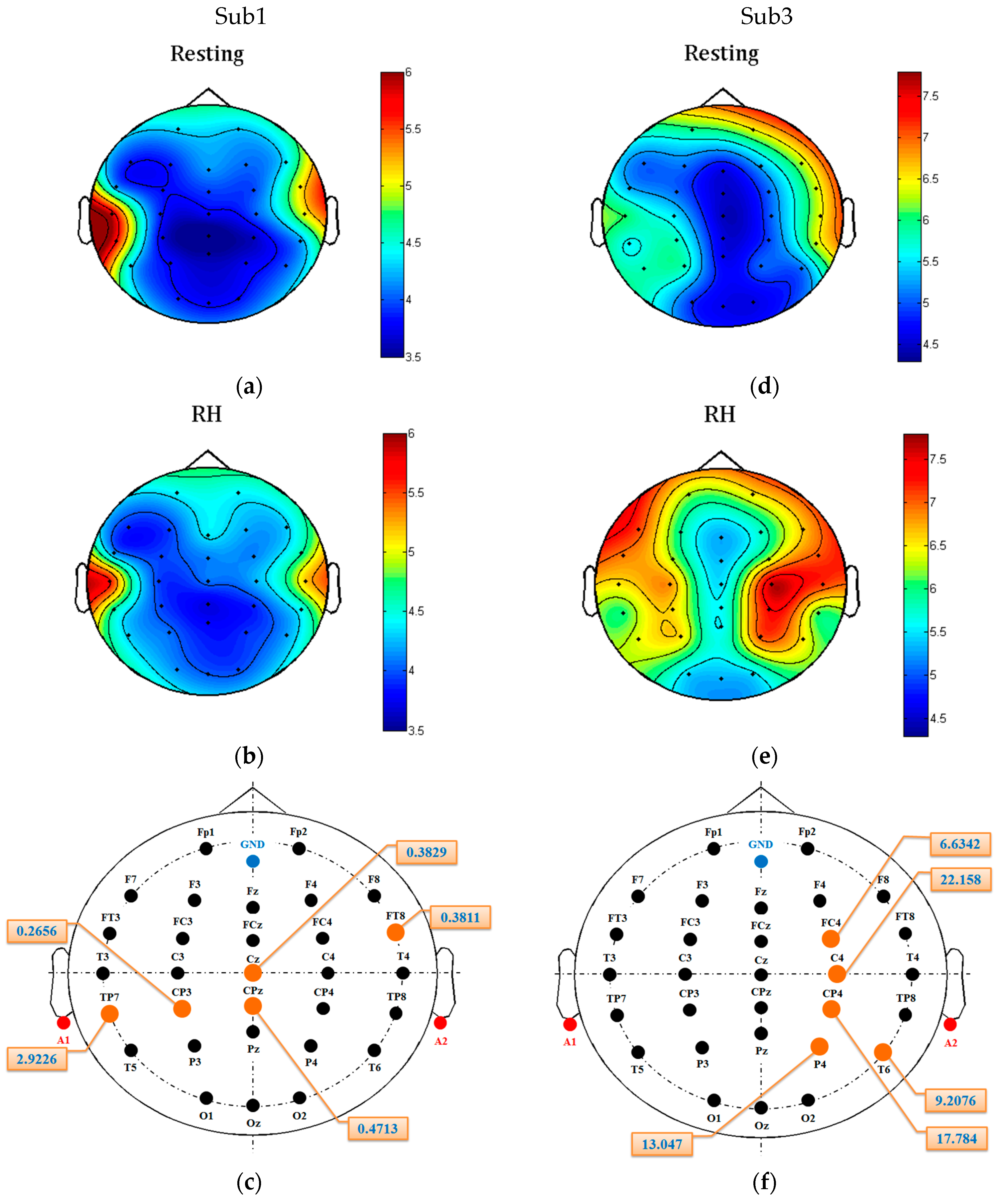 Sensors Free FullText Motor Imagery EEG Classification for