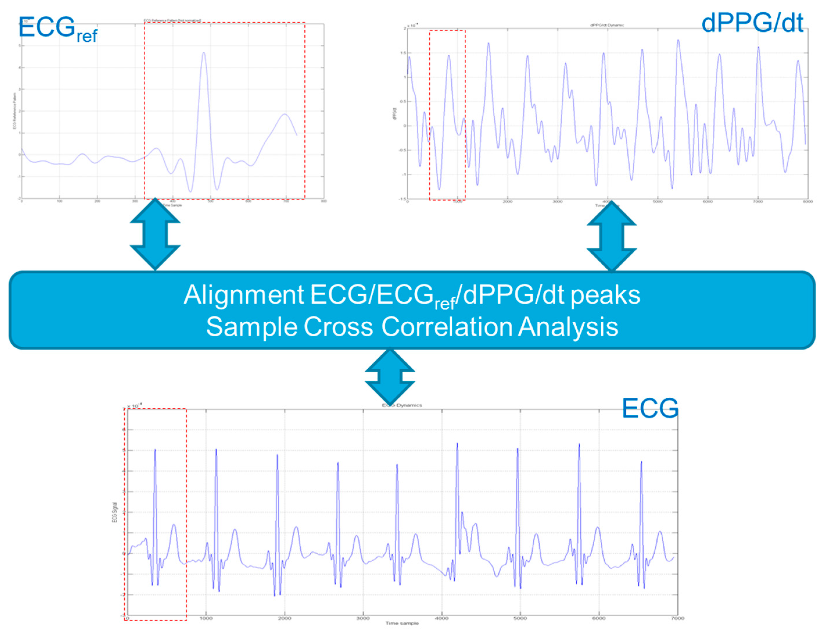 Pattern Recognition Ecg | sensors free full text an advanced bio inspired Pattern Recognition Ecg | sensors free full text an advanced bio inspired