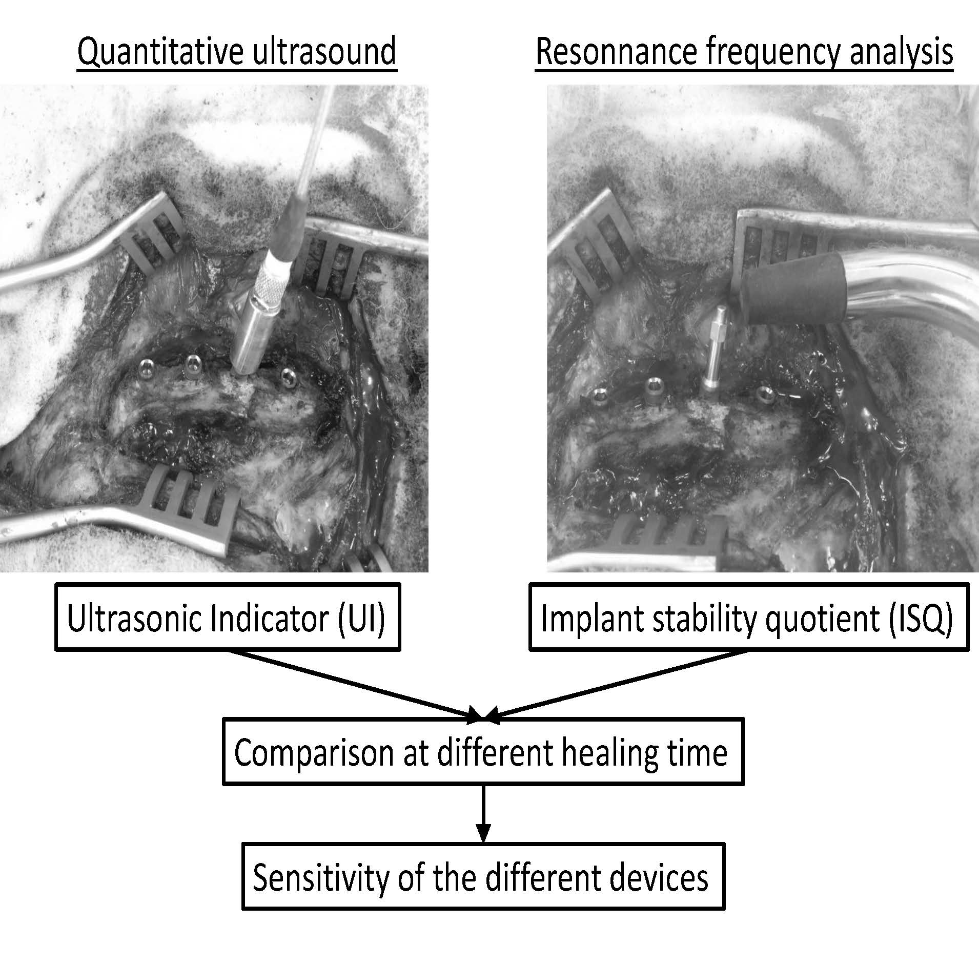 Sensors Free FullText Comparison of Resonance Frequency Analysis