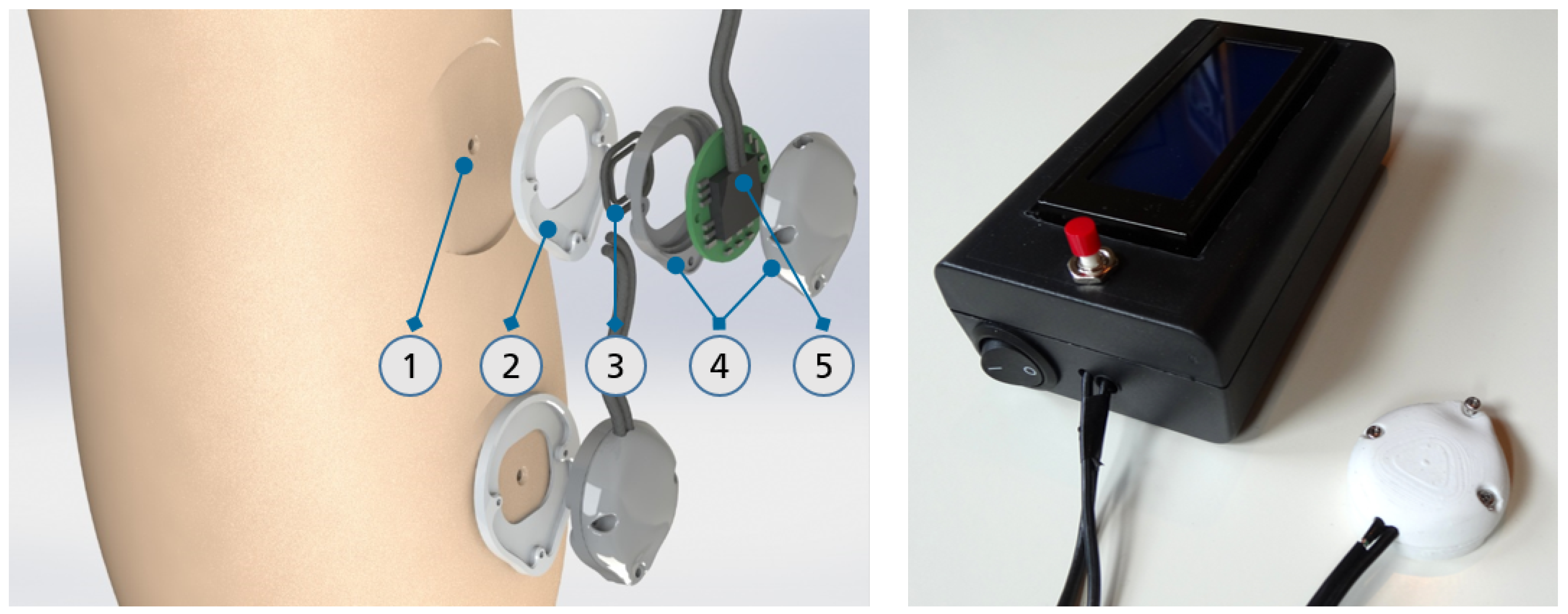 Sensors 18 02170 g001