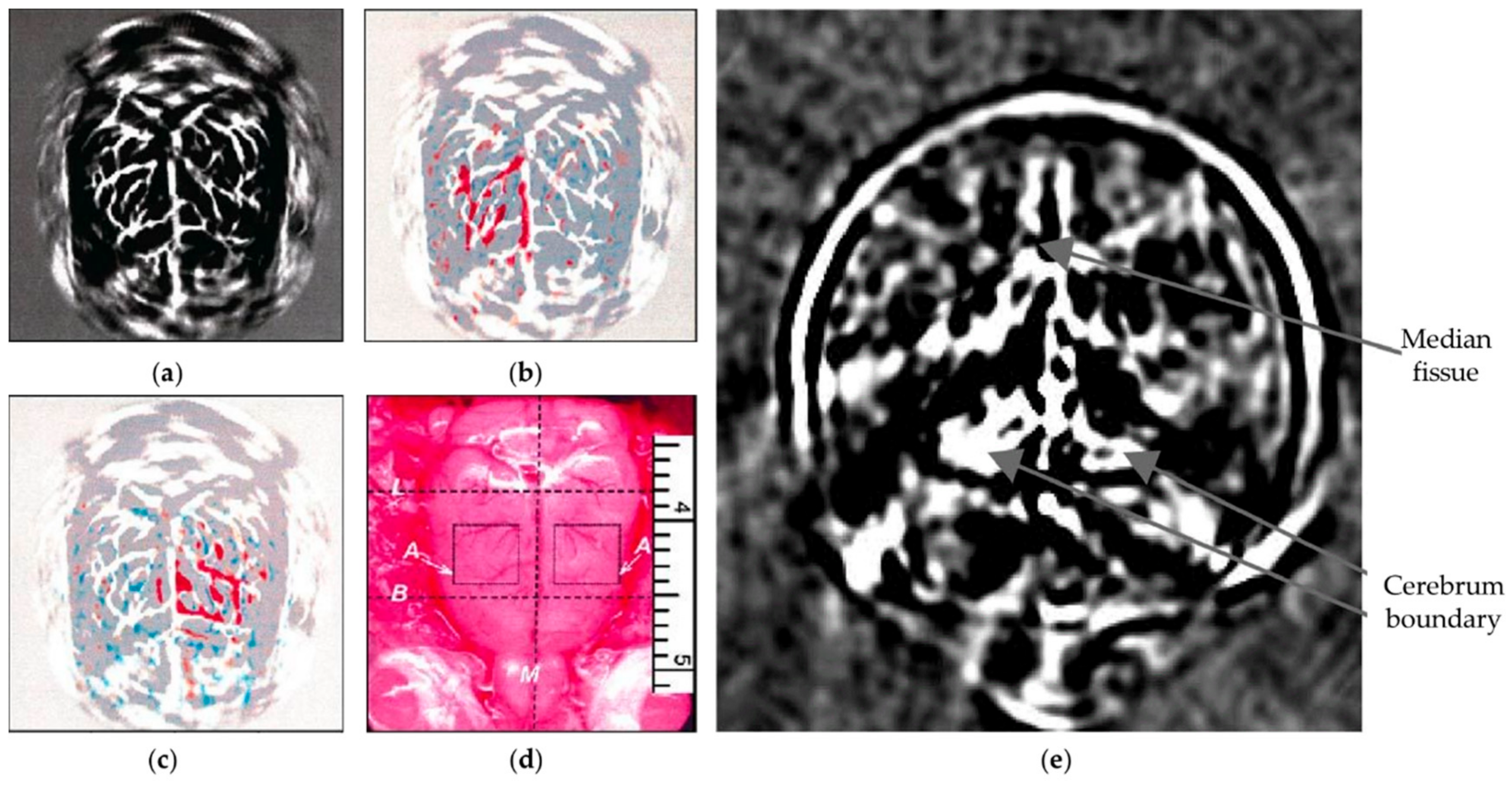 Sensors 18 03203 g002