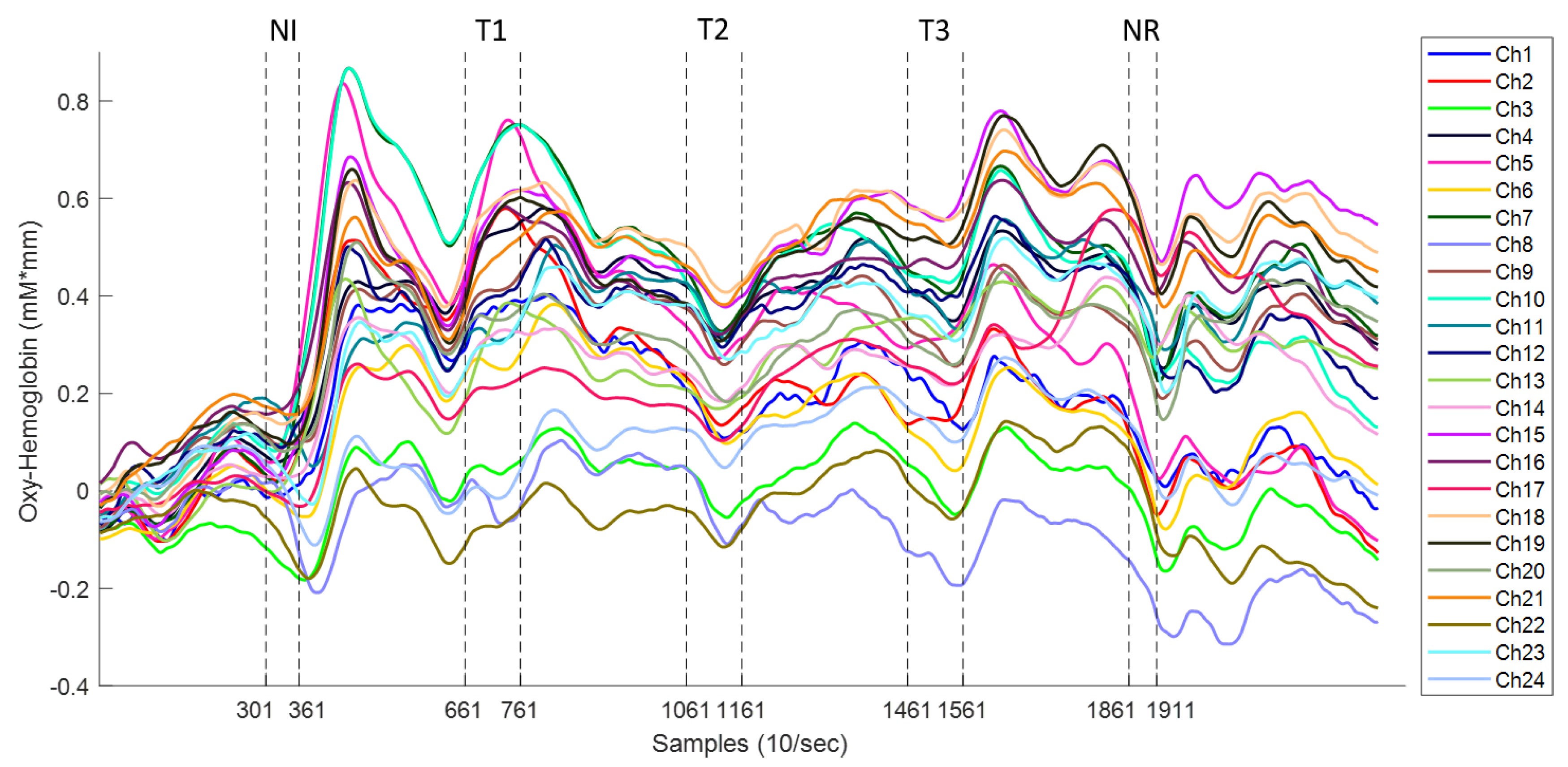 Sensors 19 00394 g004