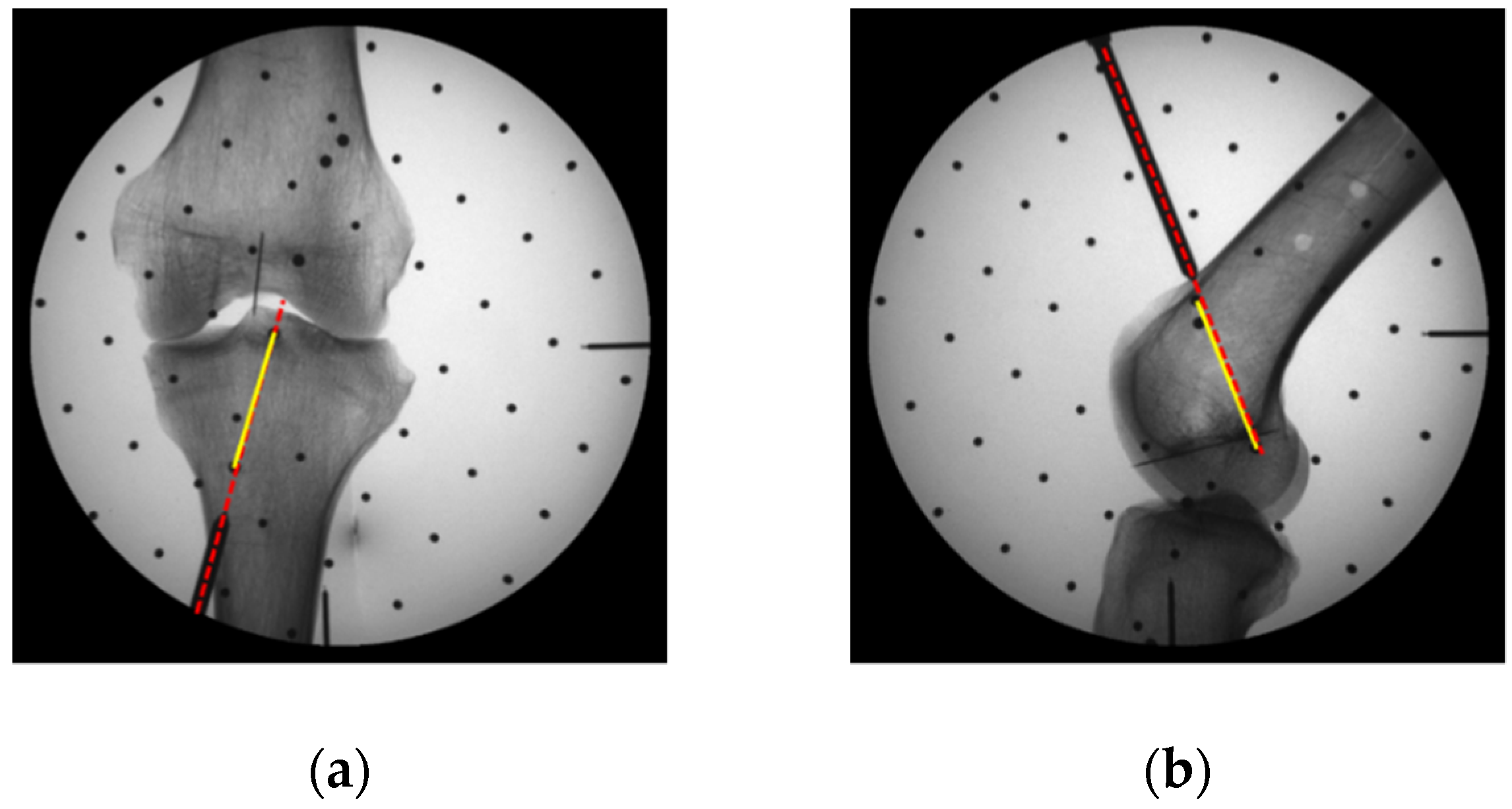 Sensors 19 01989 g017