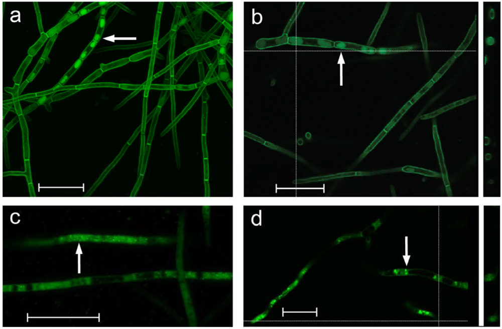 Toxins 01 00173 g003