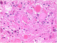 Toxins 02 01100 g007 200