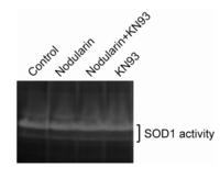 Toxins 04 01482 g006 200