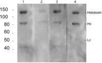 Toxins 05 02212 g005 200