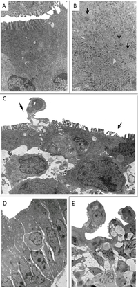 Toxins 05 02341 g002 200