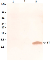 Toxins 05 02384 g001 200