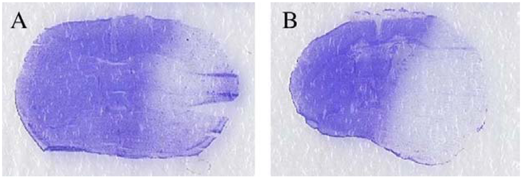 Toxins 06 00180 g004 1024