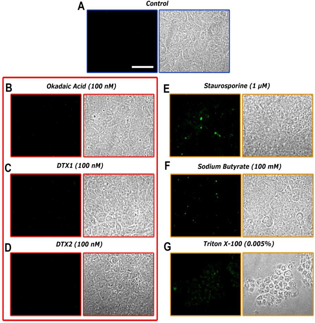 Toxins 06 00211 g003 1024