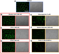 Toxins 06 00211 g005 200