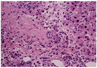 Toxins 06 00539 g009 200