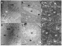 Toxins 06 01575 g004 200