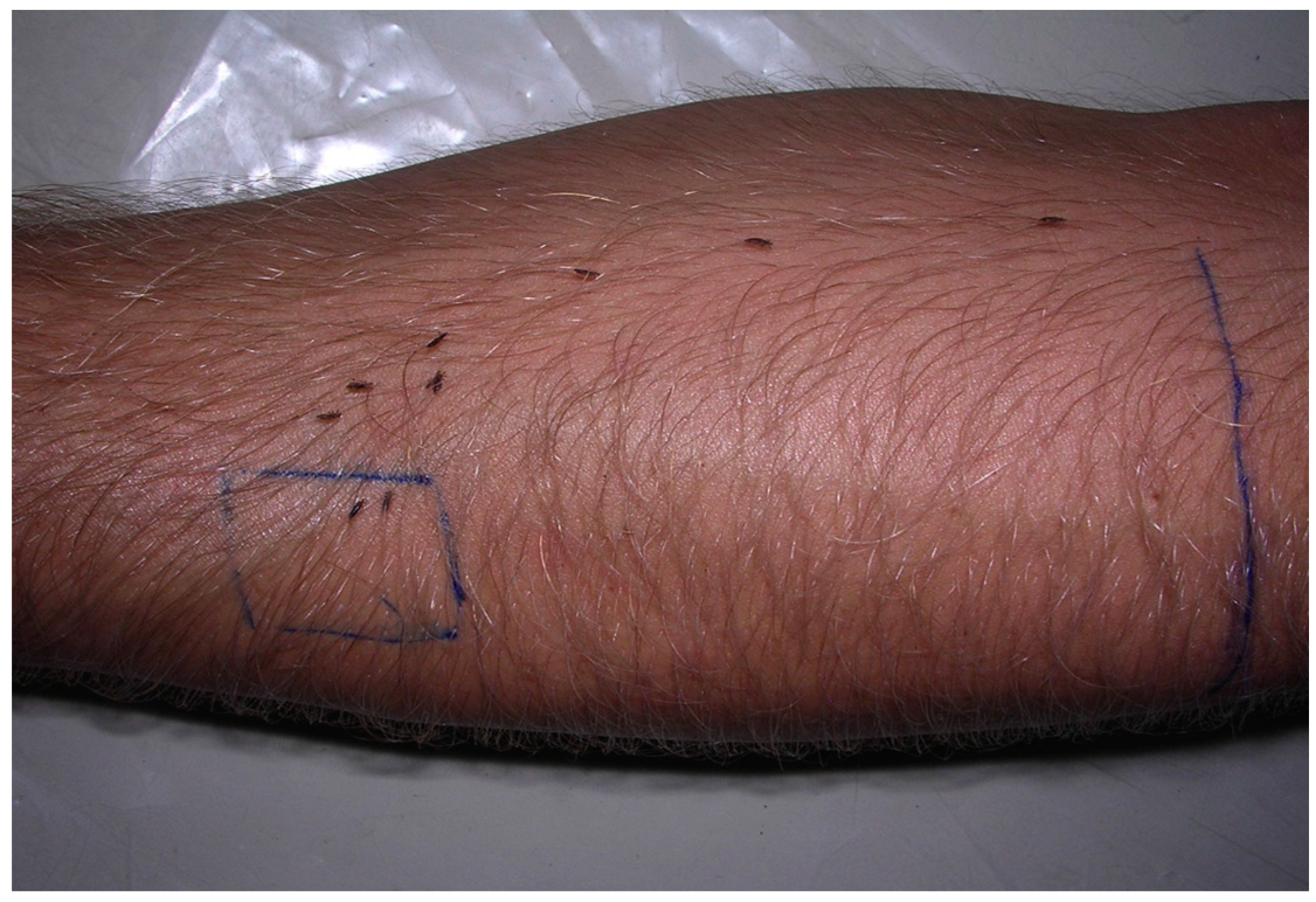 southeast asian journal of tropical medicine and blue teen linksfree pics