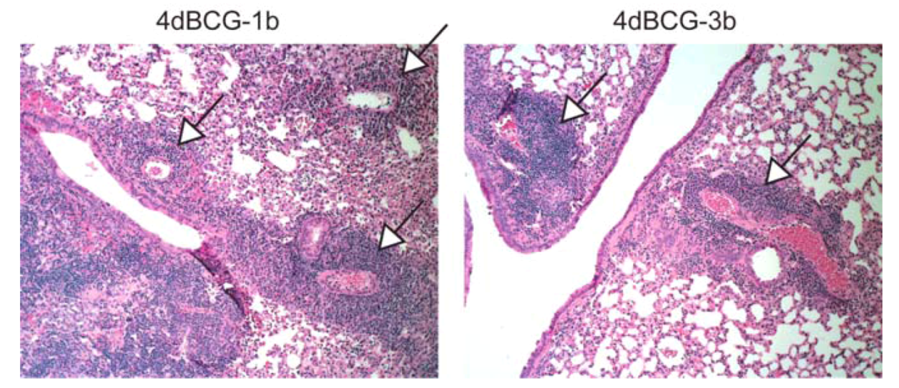 Vaccines 01 00034 g007