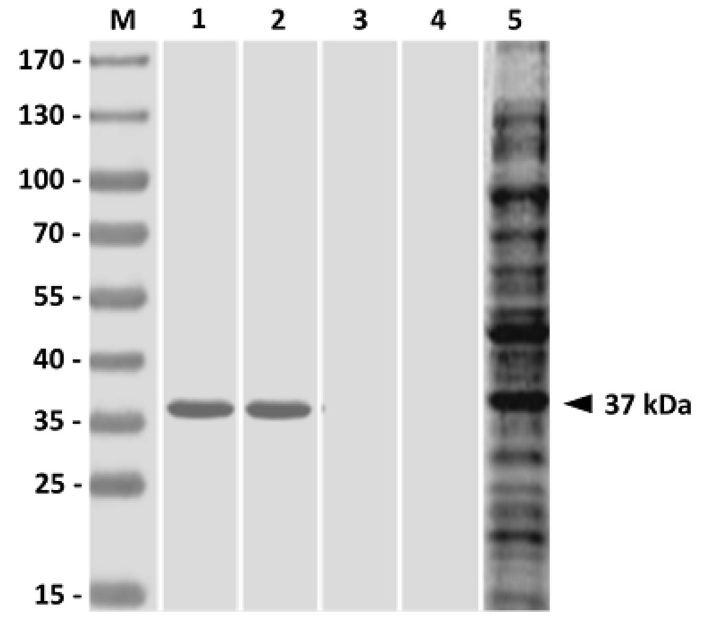 Vaccines 02 00380 g004 1024