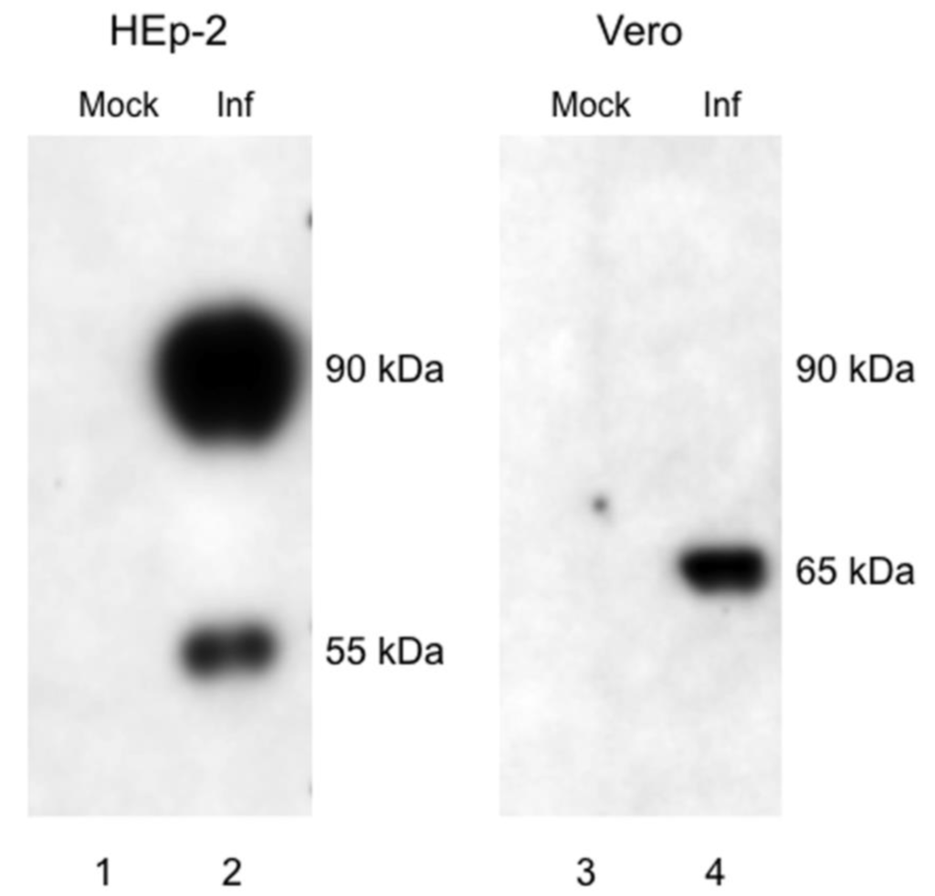 Viruses 05 02881 g001 1024