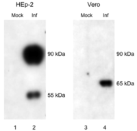 Viruses 05 02881 g001 200