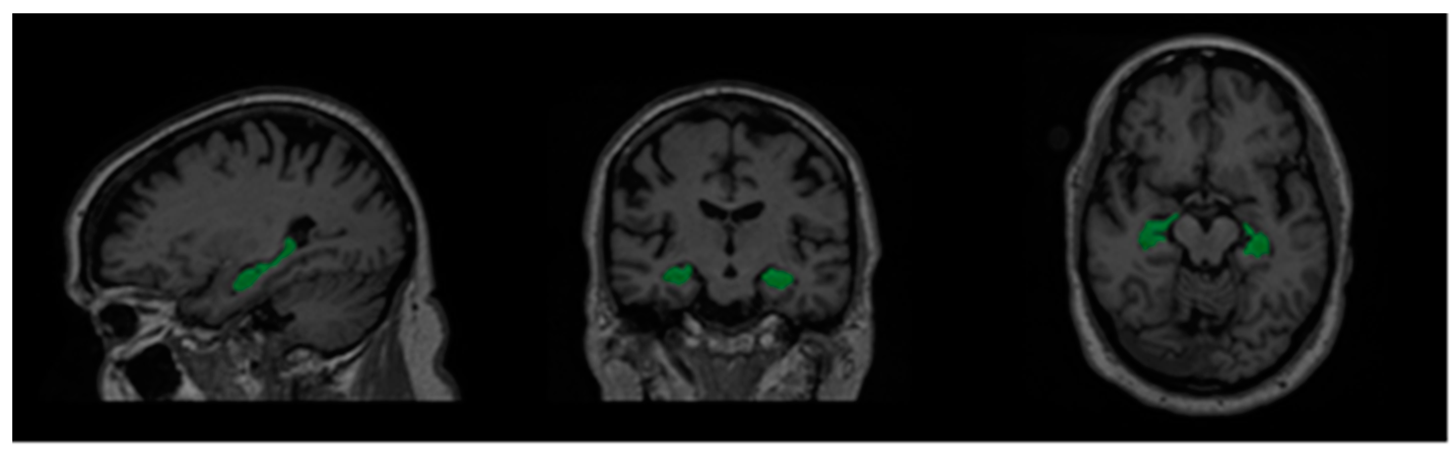 Bdcc 07 00082 g002 Bdcc 07 00082 g002