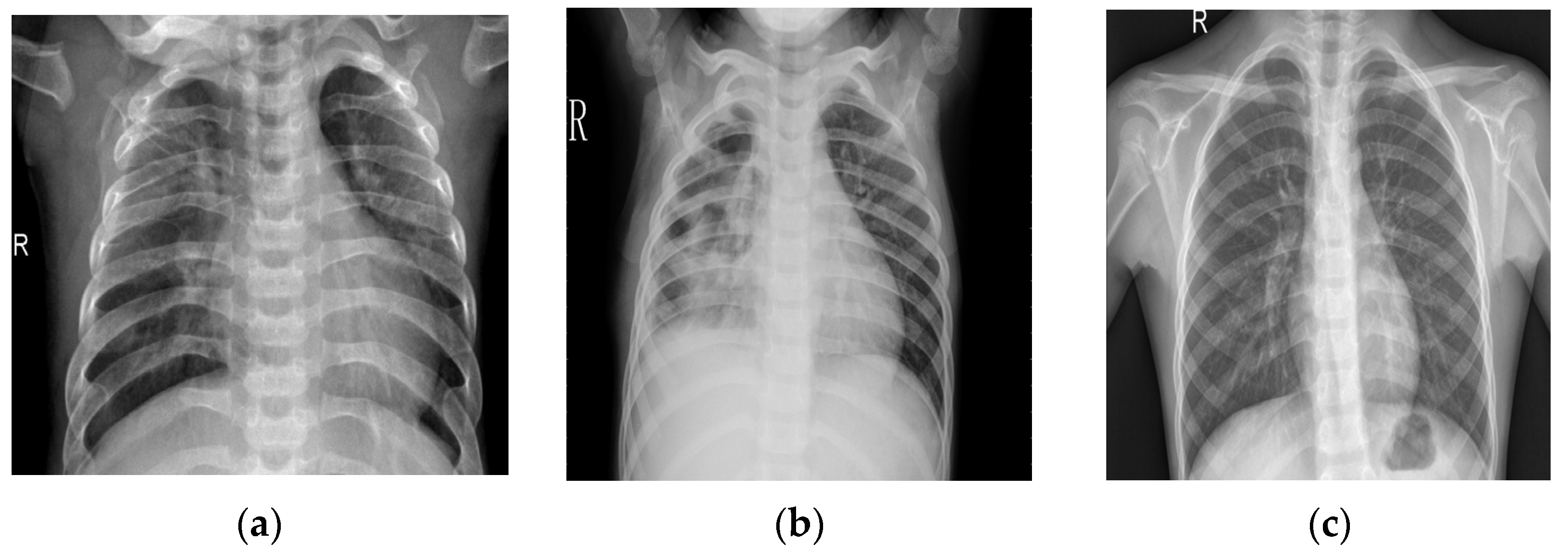 BDCC | Free Full-Text | AMIKOMNET: Novel Structure for a Deep Learning ...