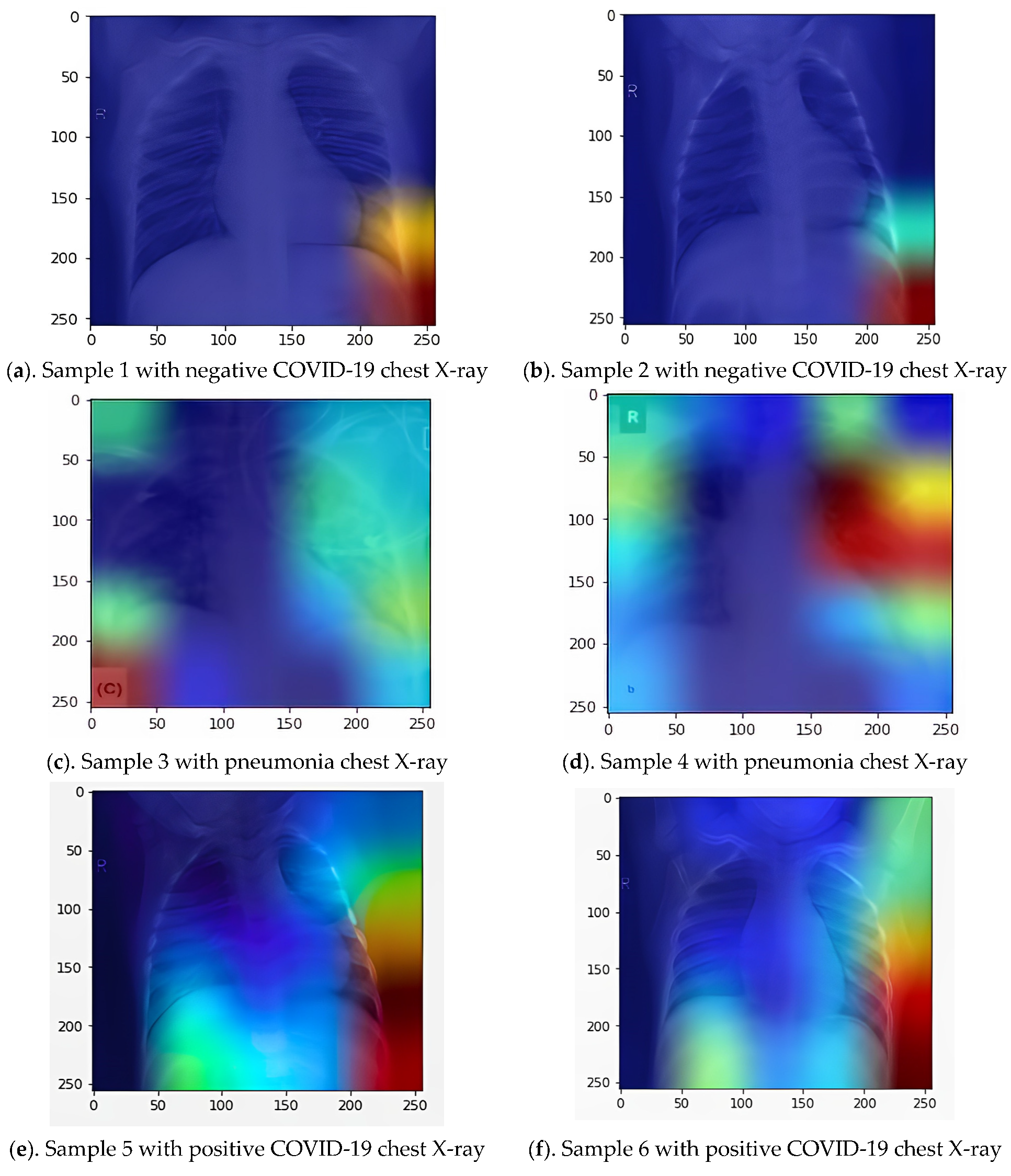 BDCC | Free Full-Text | AMIKOMNET: Novel Structure for a Deep Learning ...