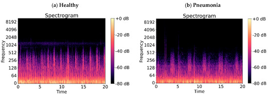 Classification and Recognition of Lung Sounds Using Artificial ...