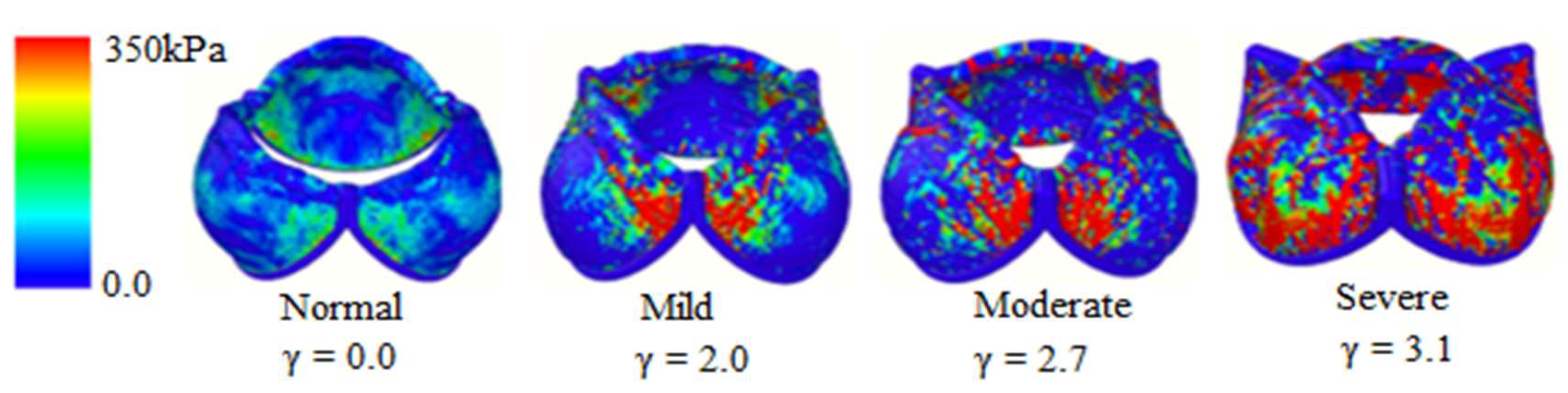 Chemengineering 04 00048 g007 Chemengineering 04 00048 g007