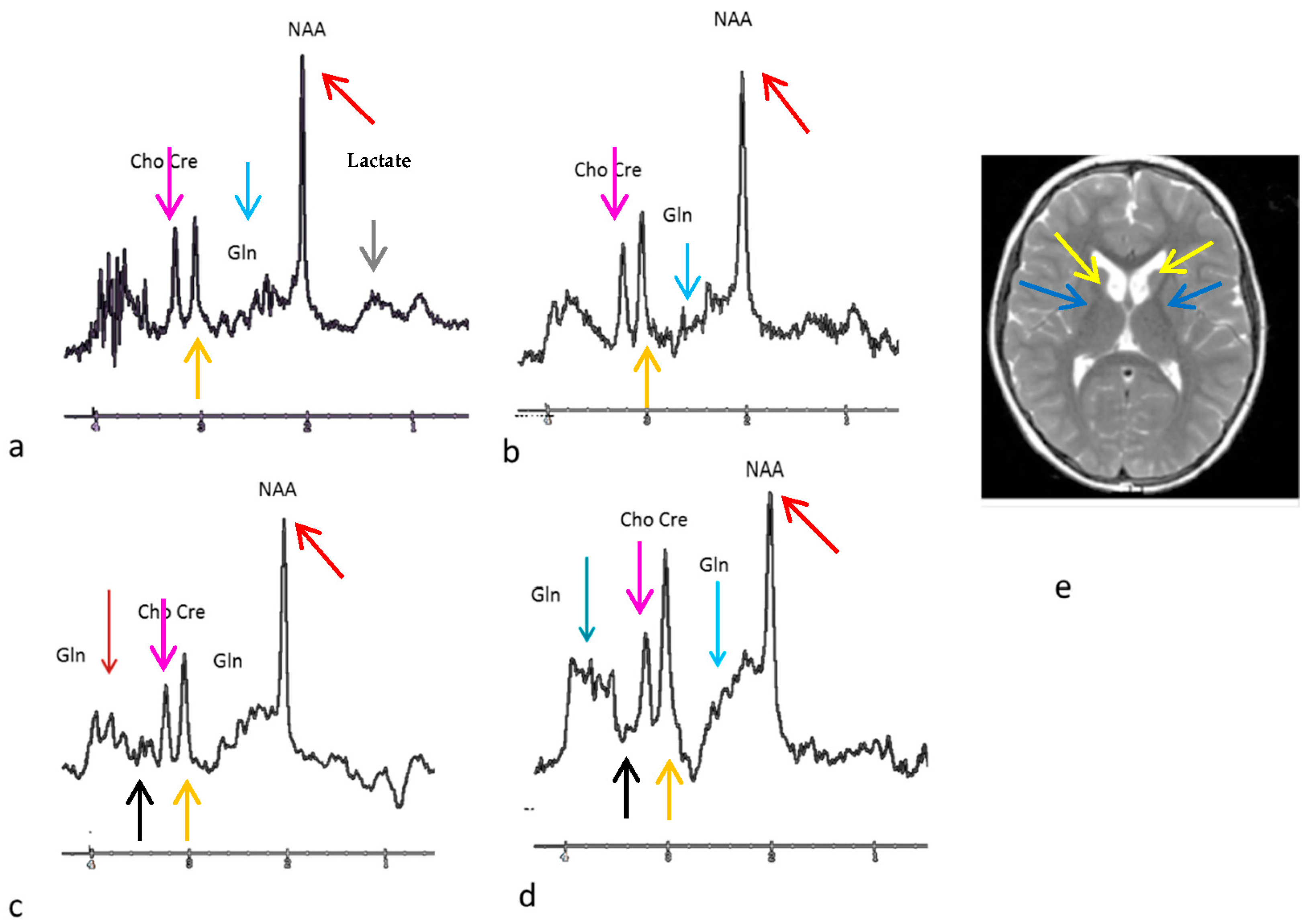 Neonatalscreening 02 00010 g004