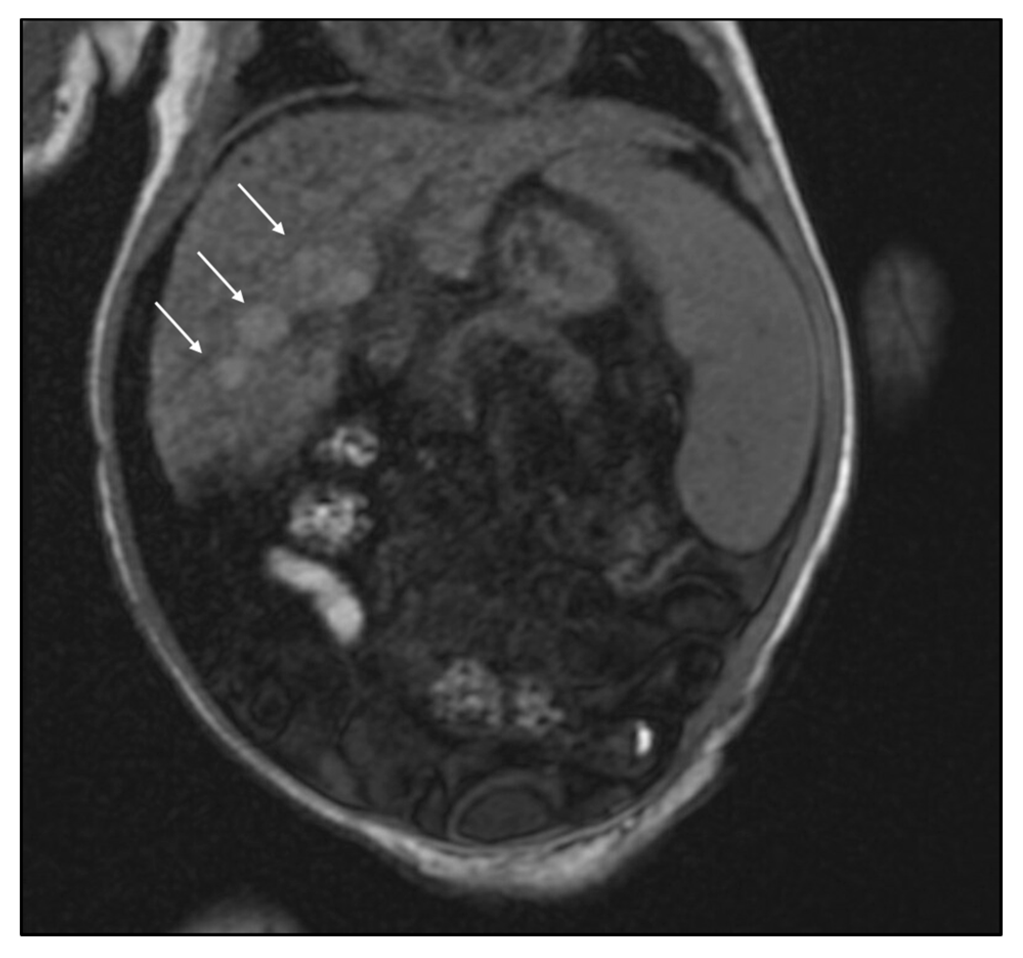 Ijns 06 00039 g002