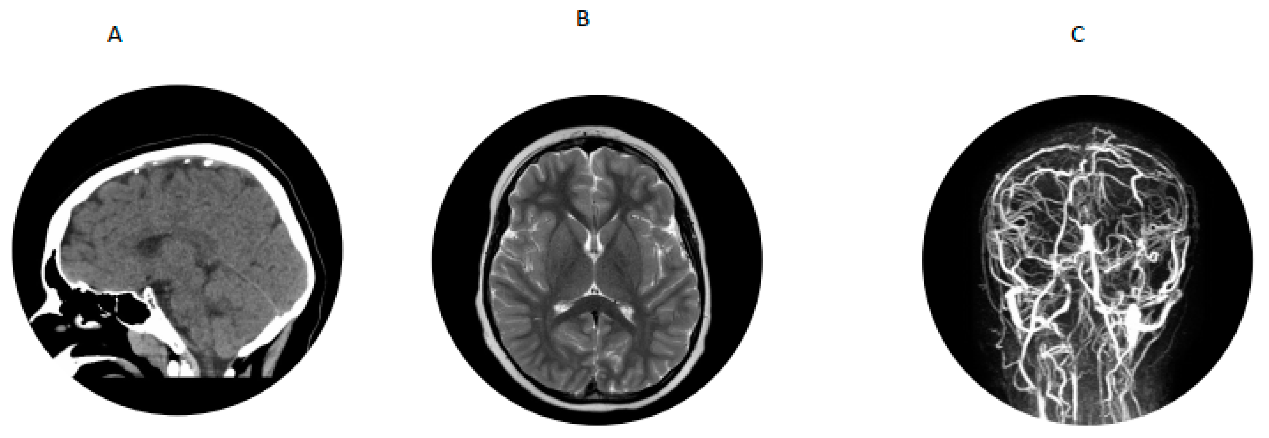 Ijns 07 00048 g002 550