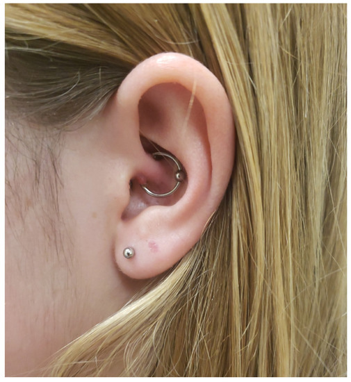 Considering a Daith Piercing? Here's What You Need to Know