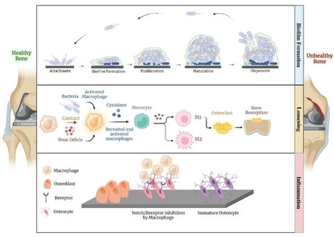 Mechanisms of infection, inflammation, and loosening on implants (sketched in biorender.com). First row: During surgery, bacteria may attach to the surface of the implant. Within the body, they start to proliferate into layers, causing the layer far from the tissue to be deprived of nutrients. These bacteria die and form a solid biofilm, which thickens and expands over the implant over time with more bacterial proliferation and dispersion. Second row: This shows the initial response of the body to the identification of bacteria in the implantation site. The activity and movement of macrophages to the infection site result in the birth of unnecessary osteoclasts, which absorb the bone and induce loosening in the contact area. Third row: The immune system may identify the implant as a harmful foreign body object that needs to be removed. Inflammation is the result of macrophage attack on the implant or inhibiting the near osteocytes’ receptors to defend. This interrupts the natural growth and maturation of osteocytes, causing loosening.