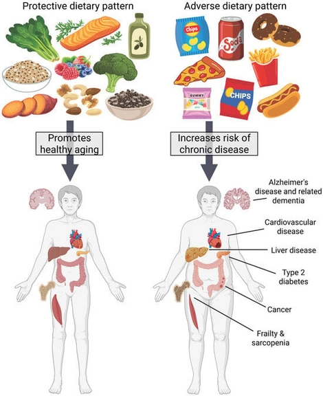 Dietary patterns contribute to healthy aging or disease development. A diet rich in whole, unprocessed foods such as vegetables, fruits, olive oil, legumes, nuts and seeds, and oily fish can contribute to the maintenance of normal cognition, metabolic health, and muscle mass and strength. A diet high in ultra-processed foods such as packaged snacks, processed meats, and sugar-sweetened beverages may contribute to systemic inflammation, poor metabolic health, neurodegeneration, cancer, frailty and sarcopenia. Created in Canva and BioRender. Gunning, J. (2026) Accessed 7 November 2025. https://BioRender.com/i2qwuqo.