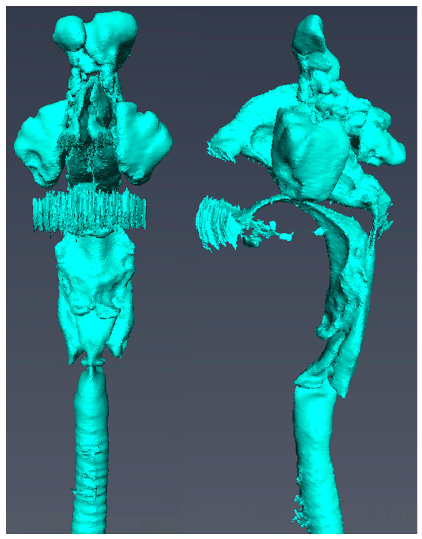 Acoustics 05 00033 g001 Acoustics 05 00033 g001