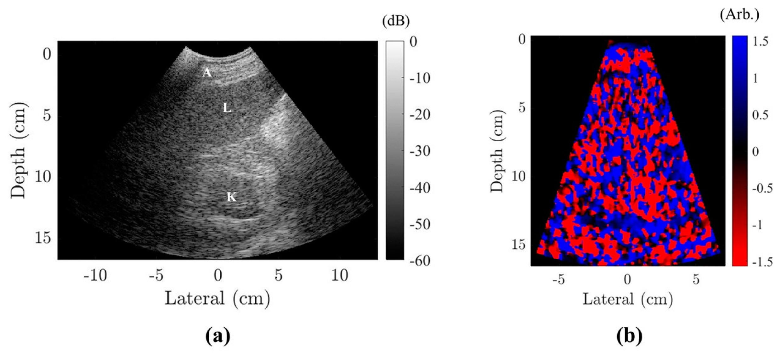 Acoustics 06 00023 g004