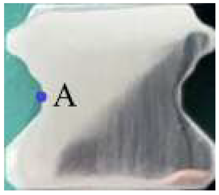 Acoustics 07 00055 g008 Acoustics 07 00055 g008