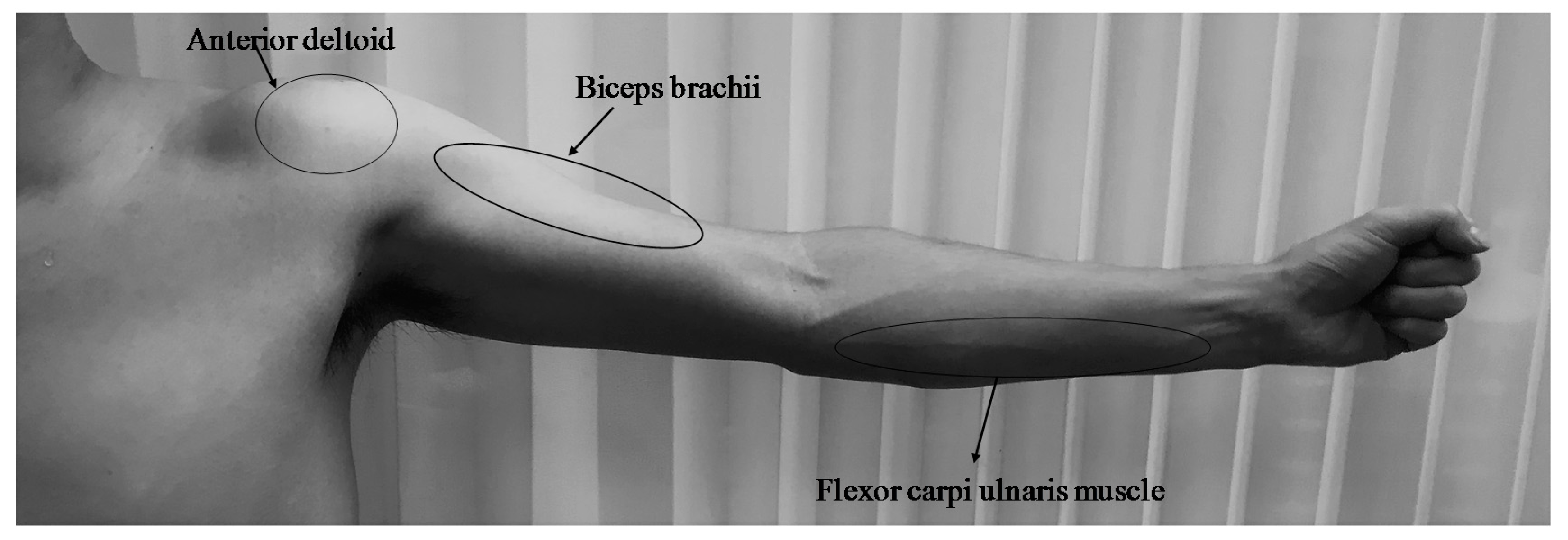 Actuators 07 00044 g007 550
