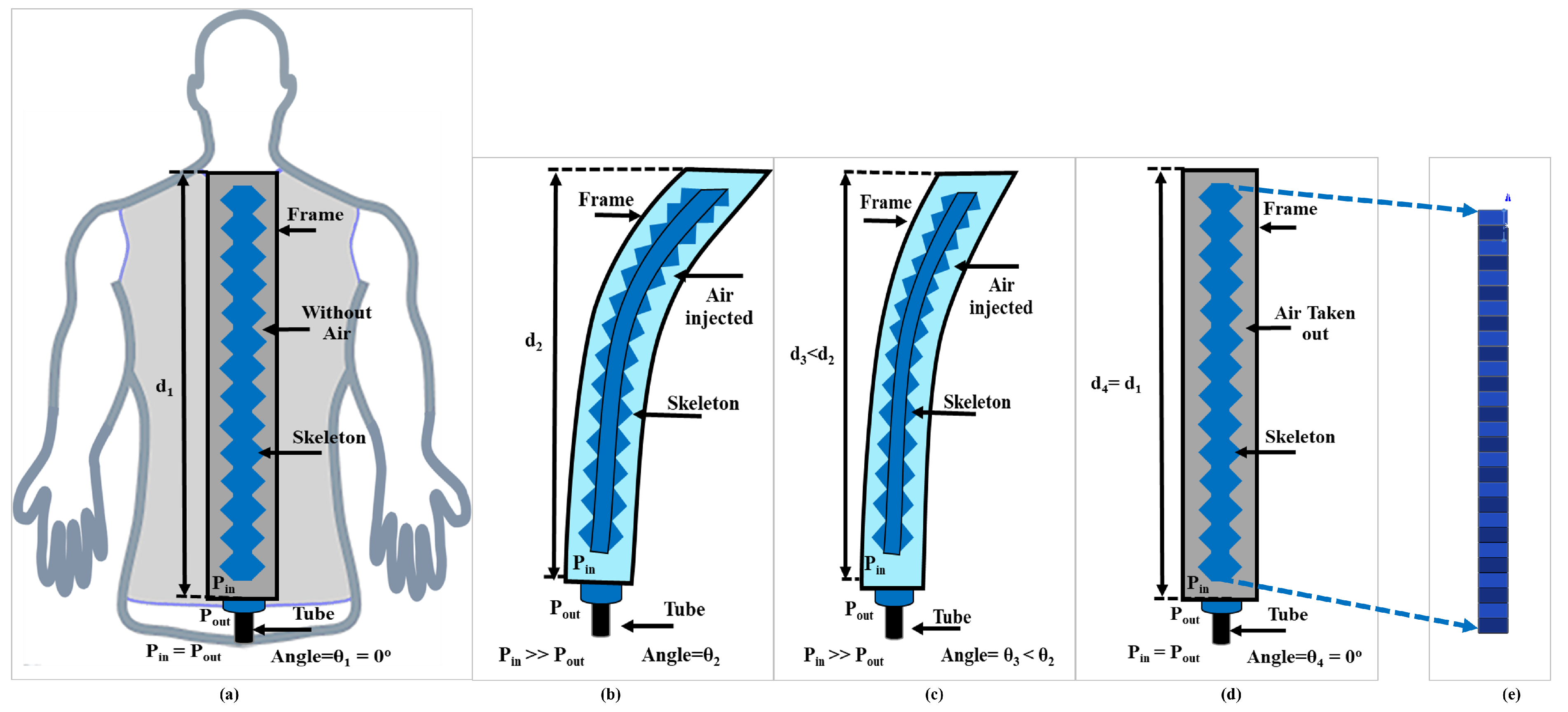 Development of an Automatic Air Driven 3D Printed Spinal Posture Corrector