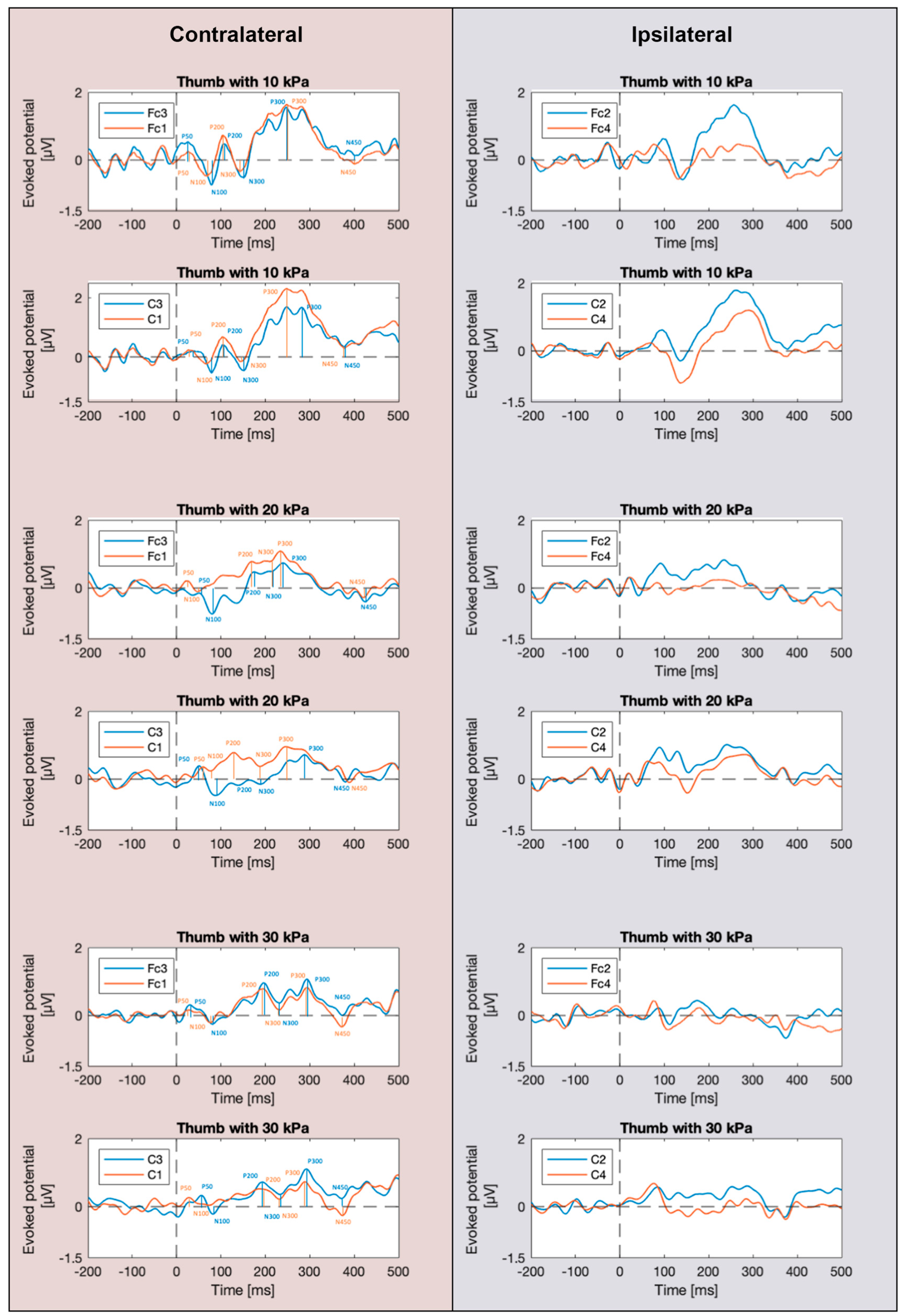 Actuators 12 00431 g003